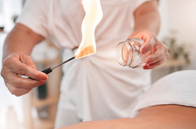 Fire Cupping Safety: What Every Practitioner and Client Should Know